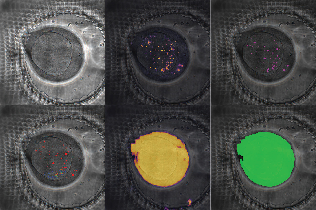 The algorithm-based segmentation of brain organoid cell culture