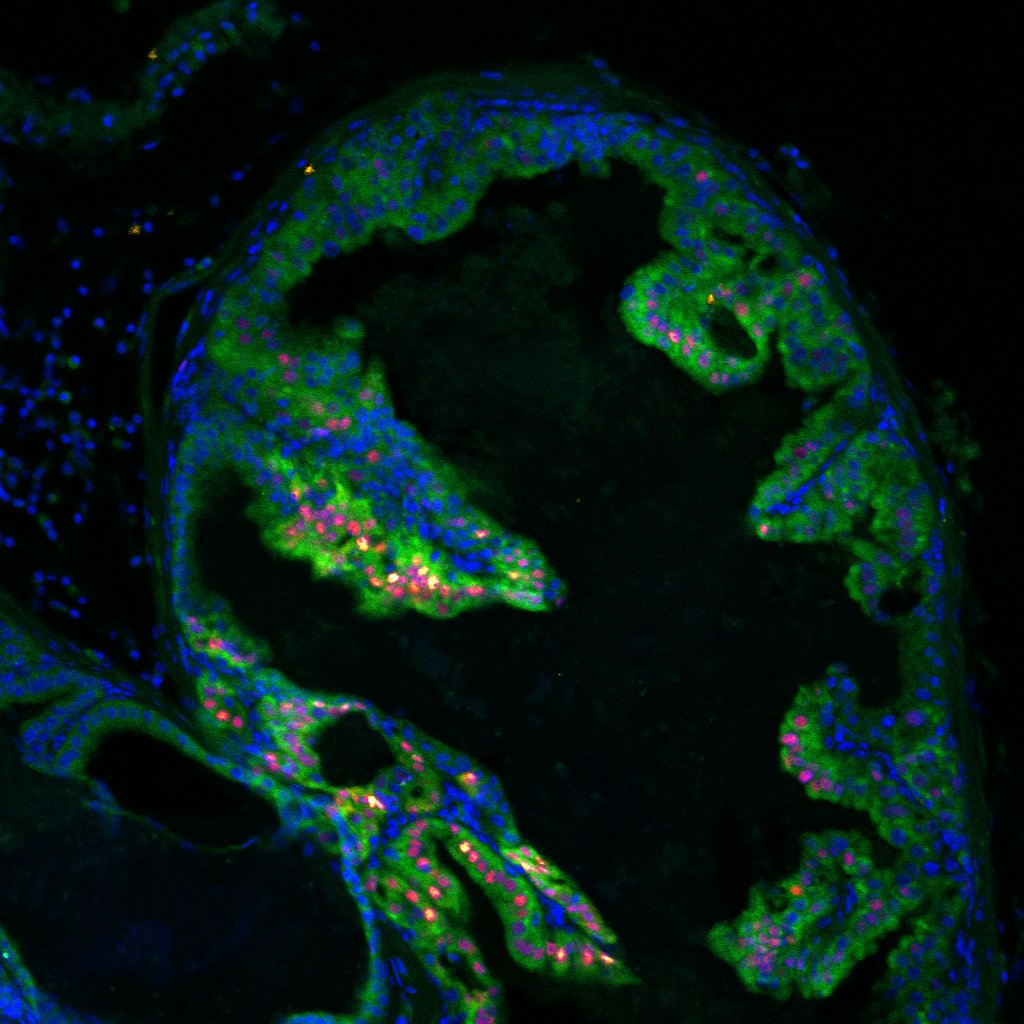 Prostate tissue histology staining