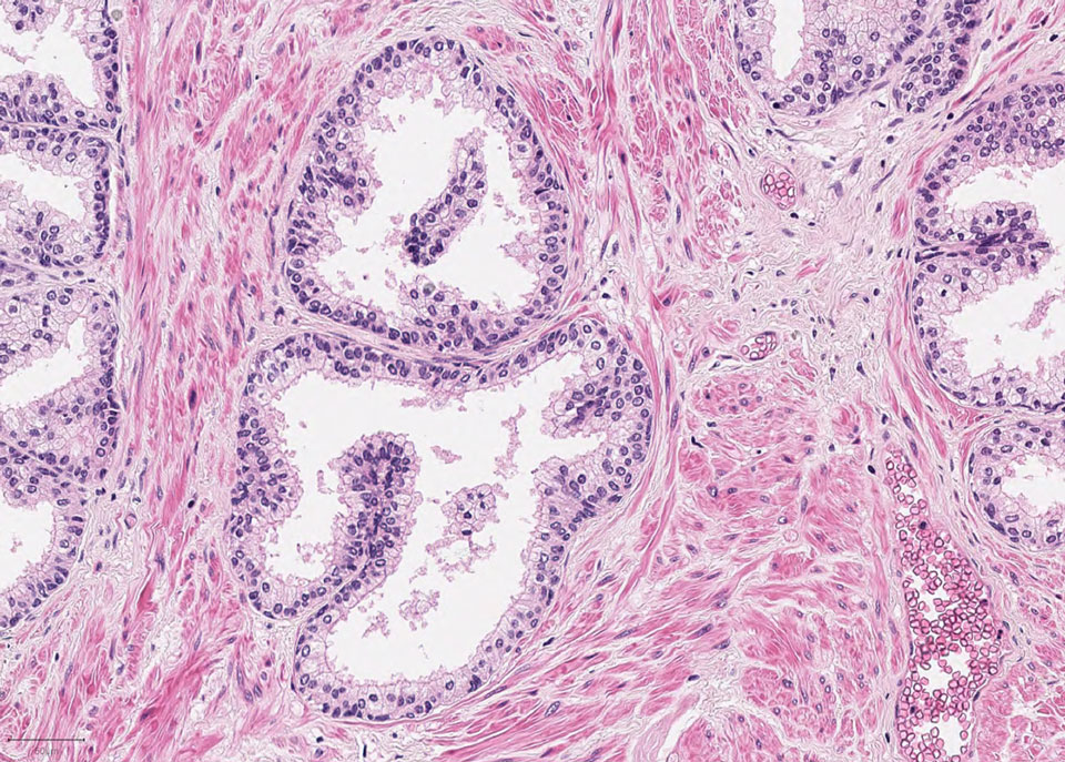 Healthy prostate tissue histology slide
