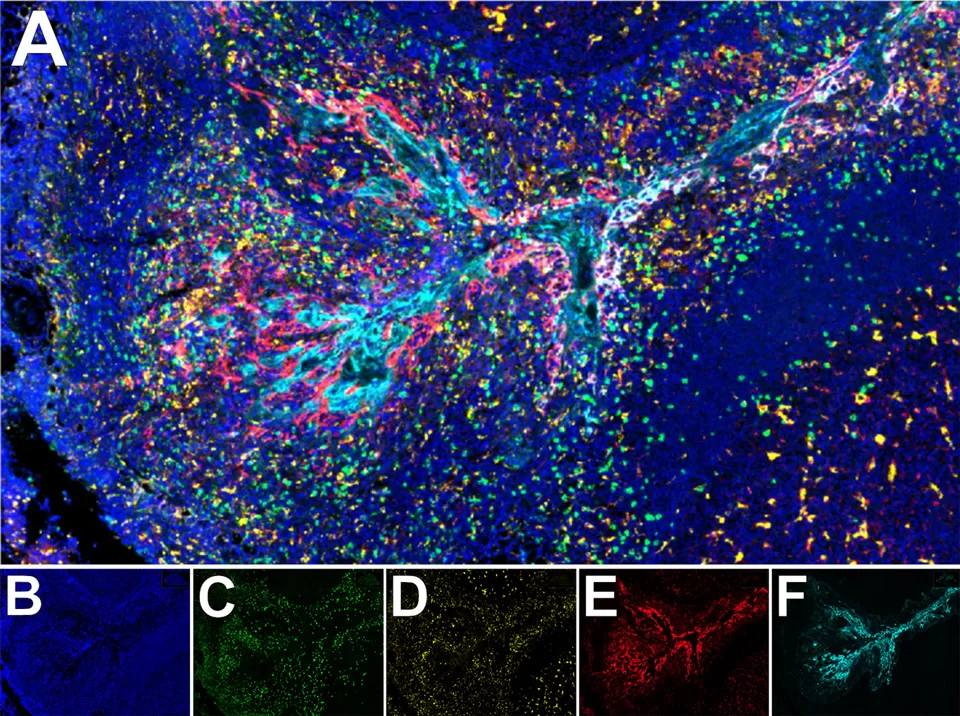 multiplex IHC image human tonsil