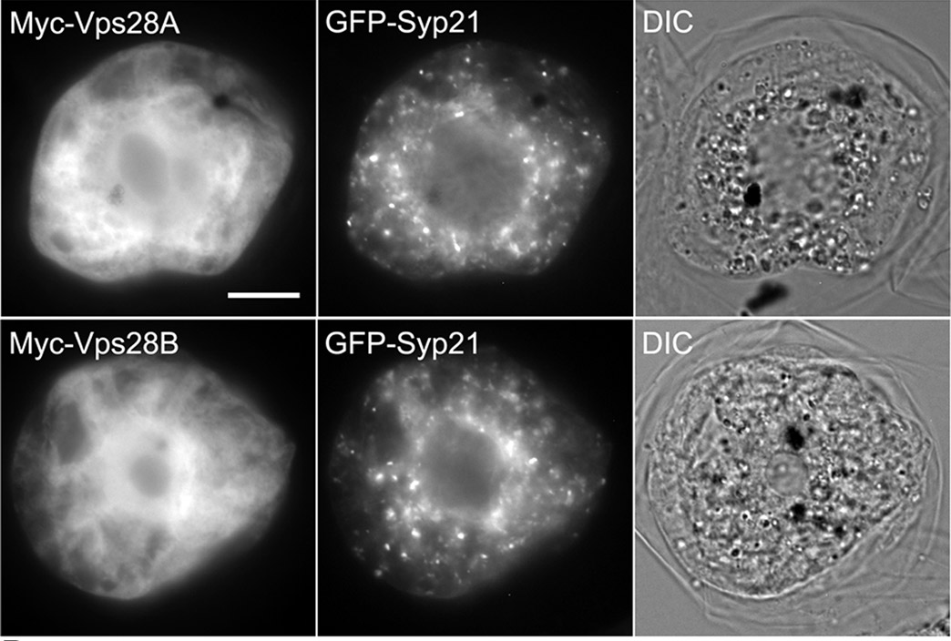 A Cells were processed and imaged by fluorescence microscopy Also seen here are subcellular localization of Vps28A and Vps28B 