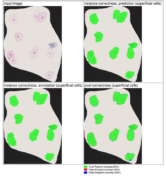 cell detection classification