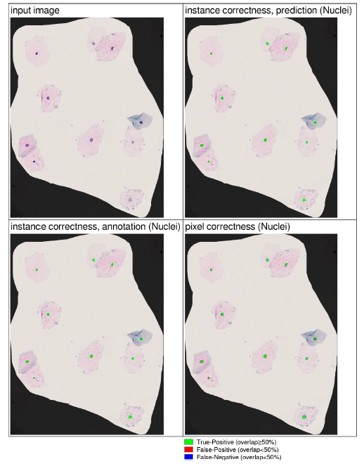 nuclei detection classification