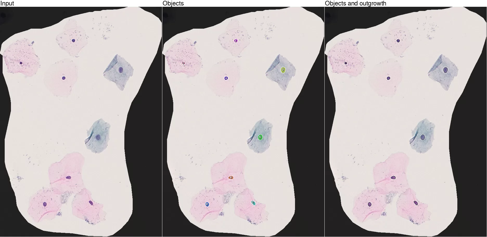 nuclei detection