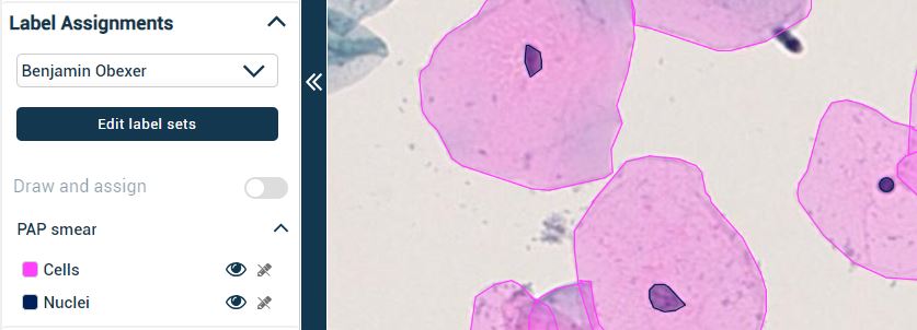Label assignment by a user to cells and nuclei on Pap smear images in IKOSA