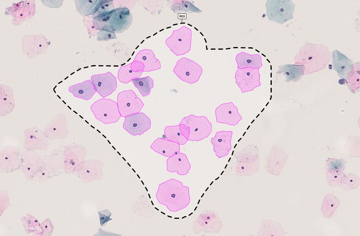 Region of interest with annotated and labeled cell and nuclei on Pap smear image in IKOSA