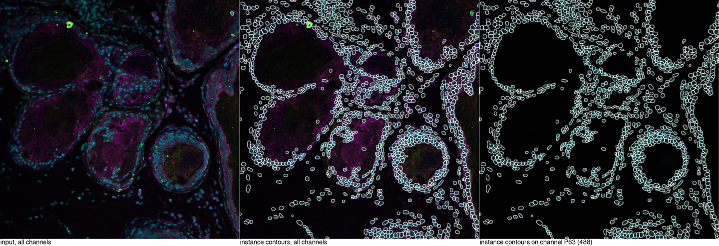 Nuclei segmentation and nearest neighbor analysis within a multichannel image with our ready-to-use Sparkfinder App