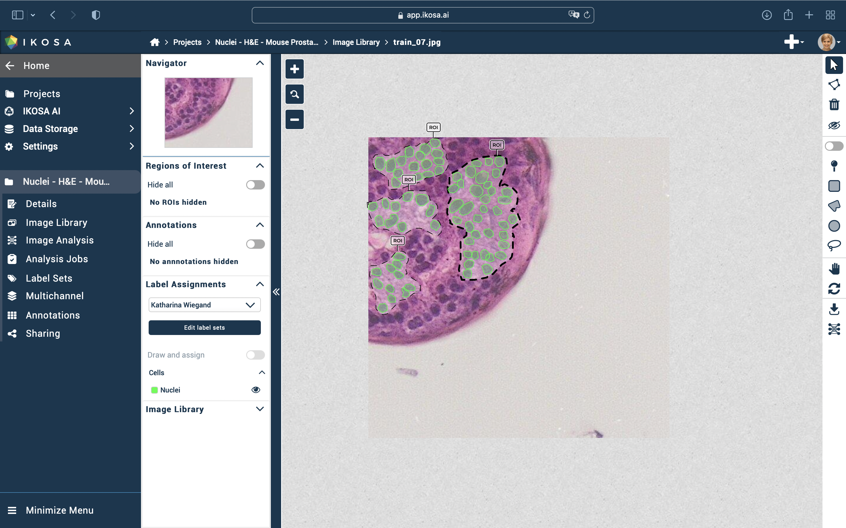 ROIs for nuclei segmentation app training