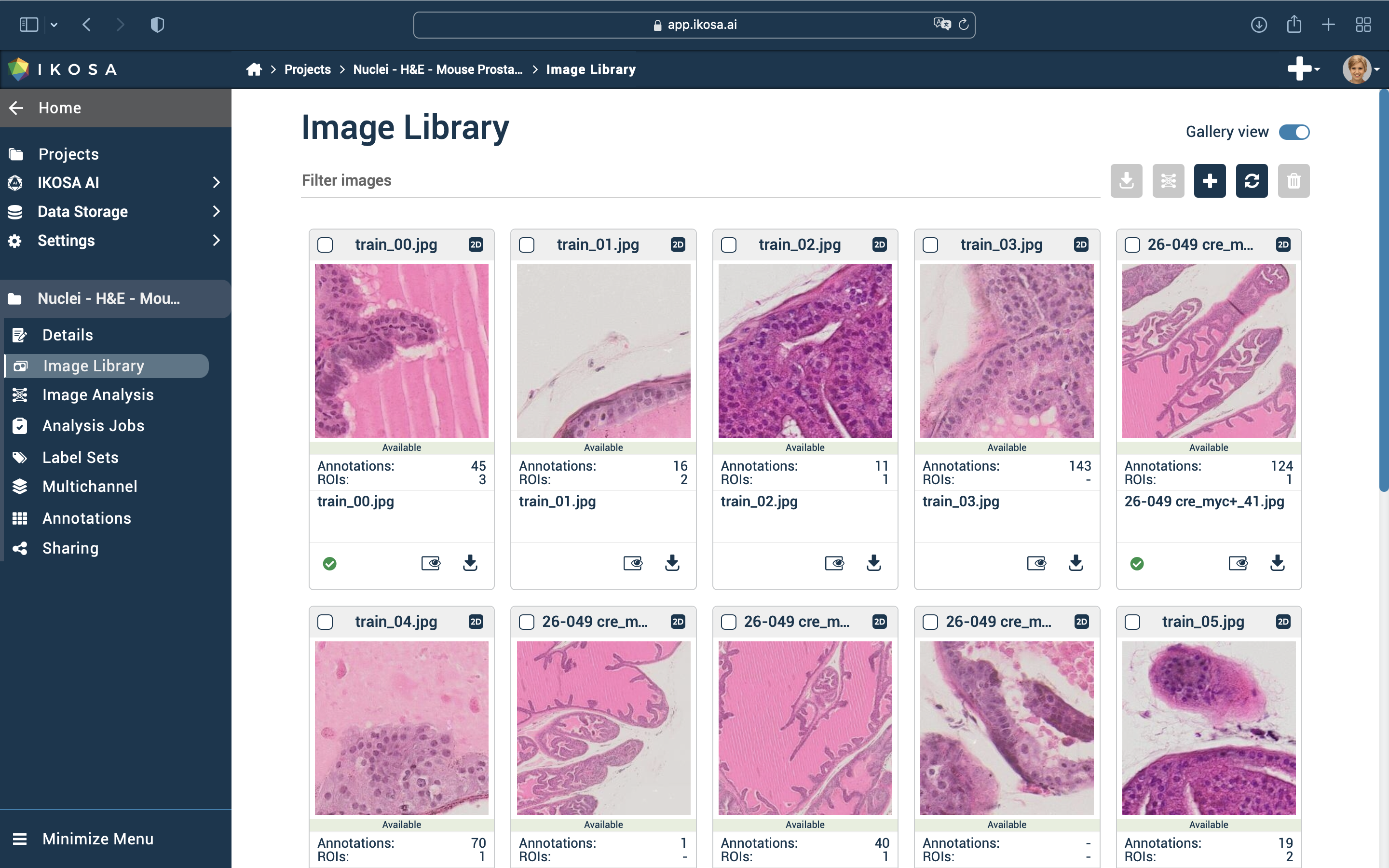 input images for nuclei segmentation app training