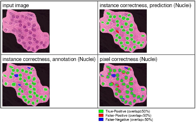 nuclei segmentation with deep learning