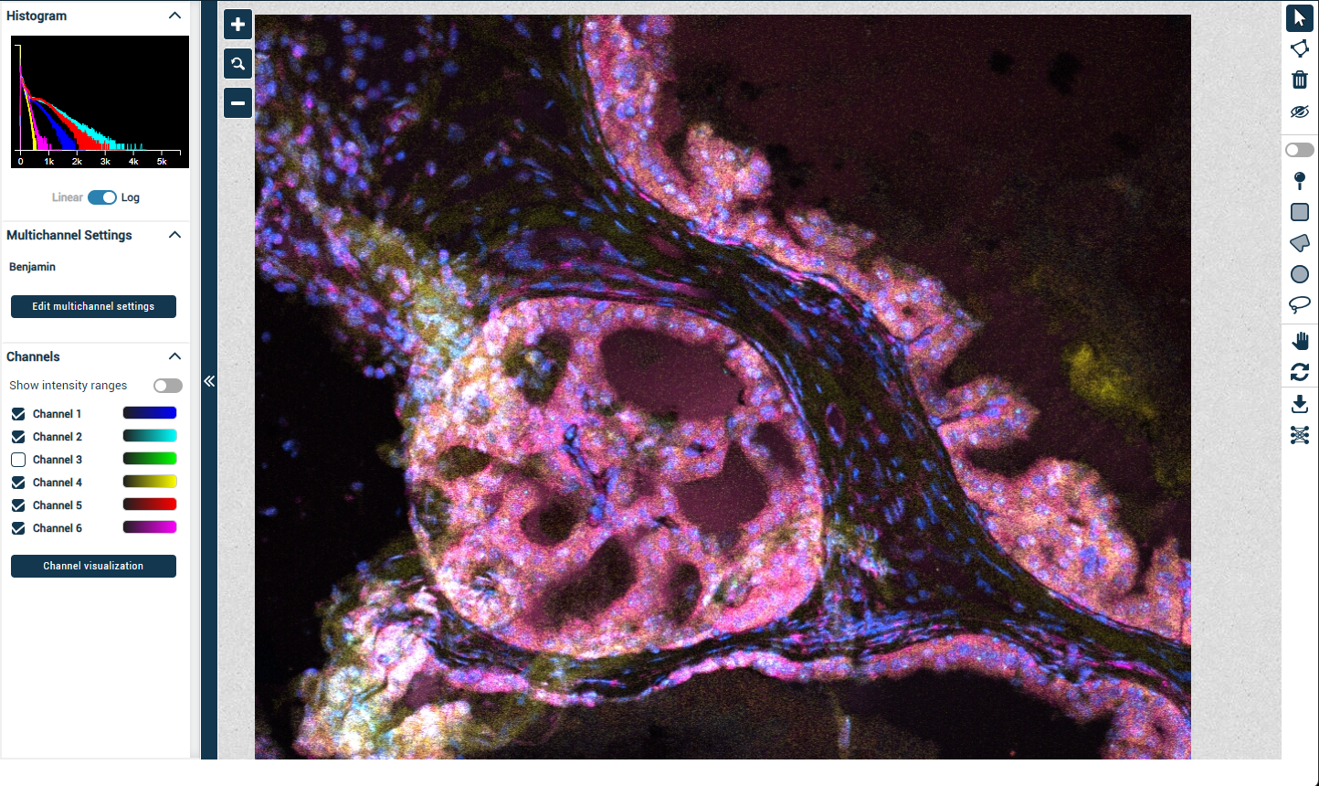 prostate tissue histology multichannel imaging 
