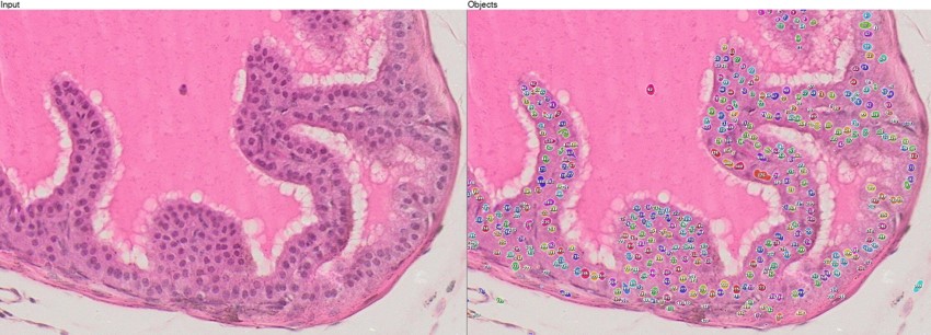 nuclei segmentation on mouse prostate tissue using IKOSA AI