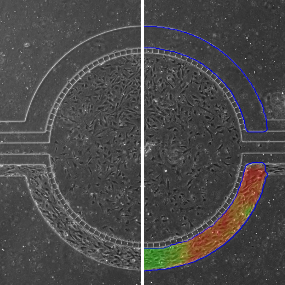 Lumen Standardization IKOSA Prisma microscopy image analysis software Lumen Standardization IKOSA Prisma microscopy image analysis software